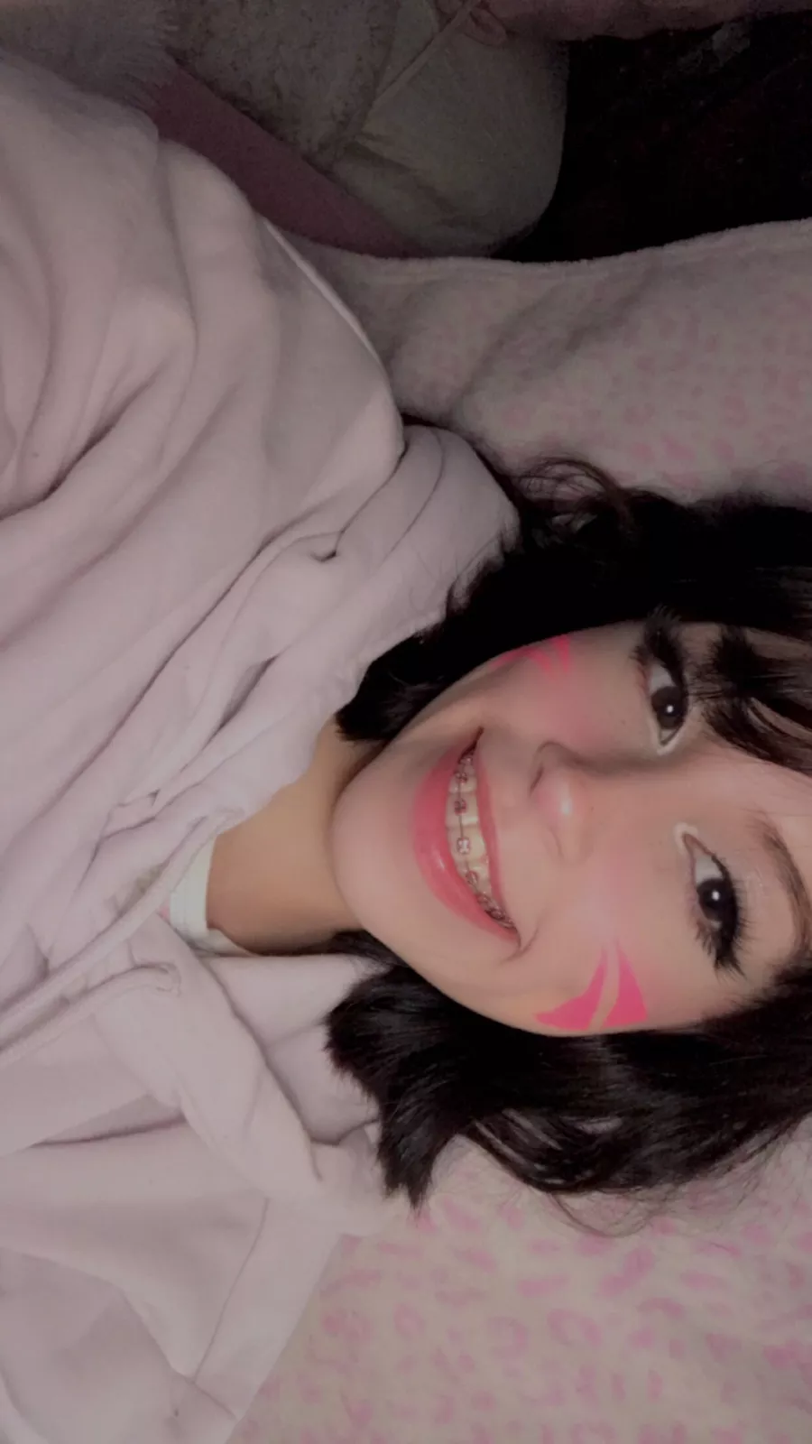 please cover my braces in cummmmm