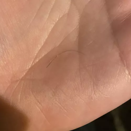 About a month ago, I had a pop on my bewb that I posted. It would scab over and then fill with pus again. The scab came off in the shower and I thought I saw something inside and I pulled out this hair! 😱 it’s about an inch long!