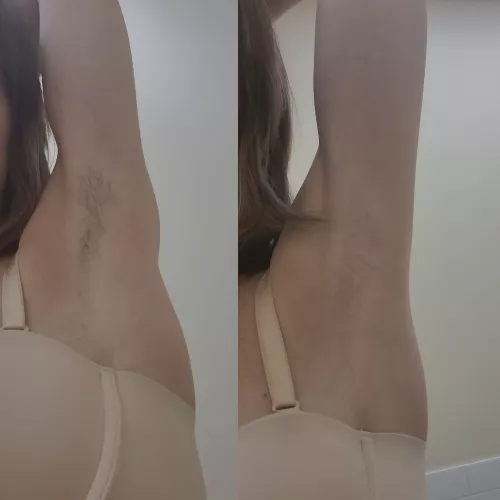 Before and after getting waxed.... what's your preference?