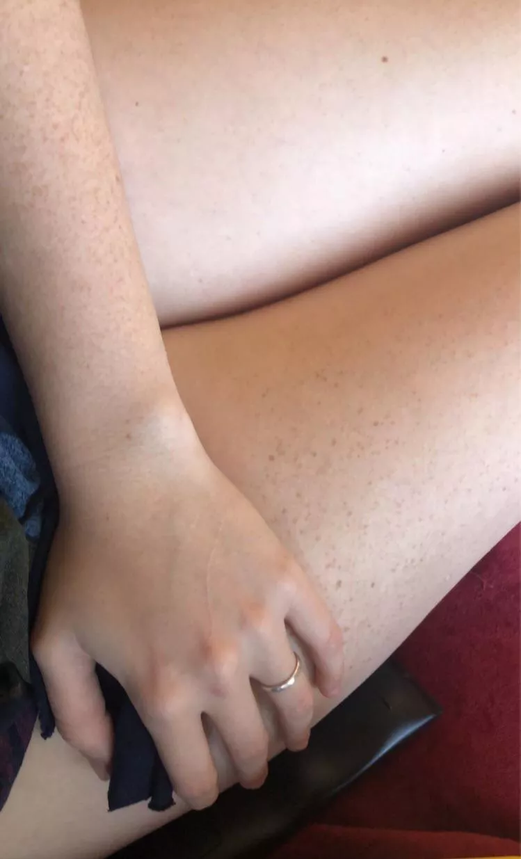 Freckle speckled thighs