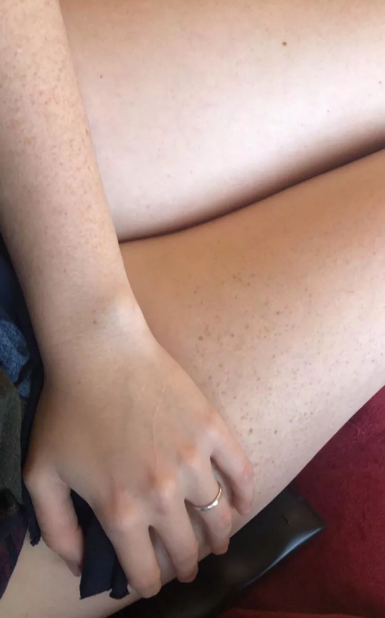 Freckle speckled thighs