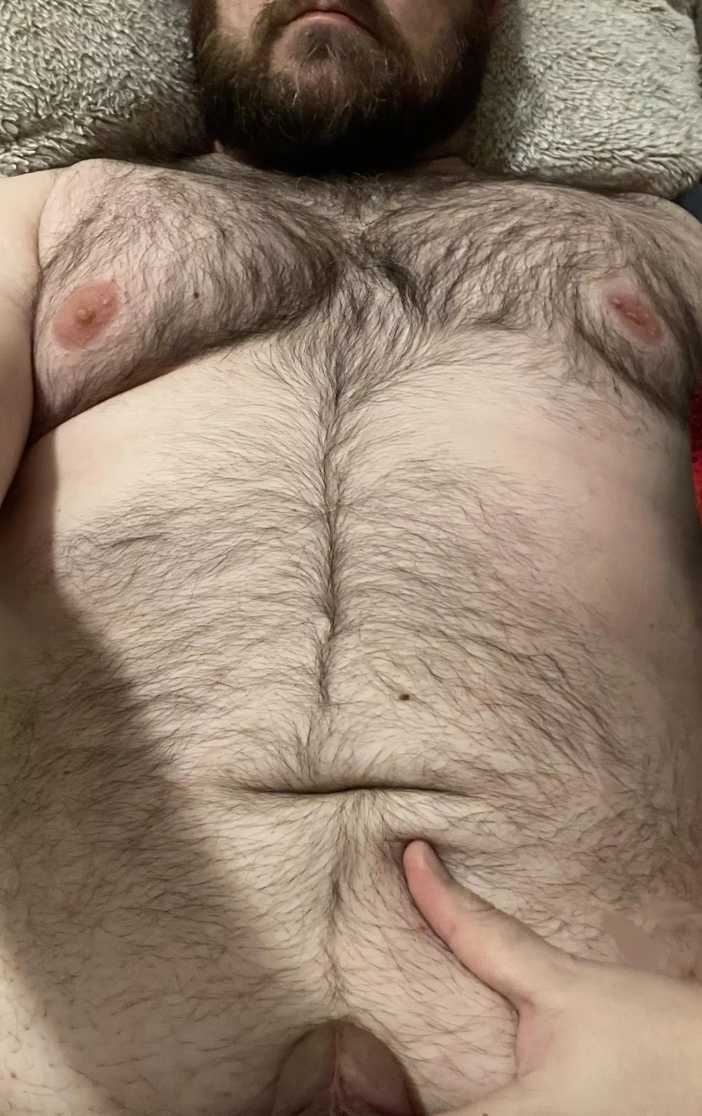 Being hairy