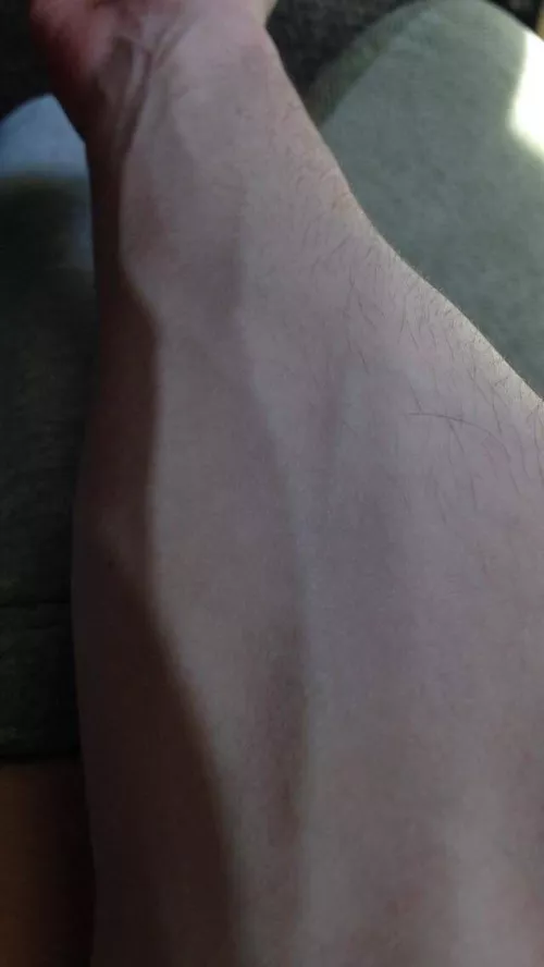 Post workout veins