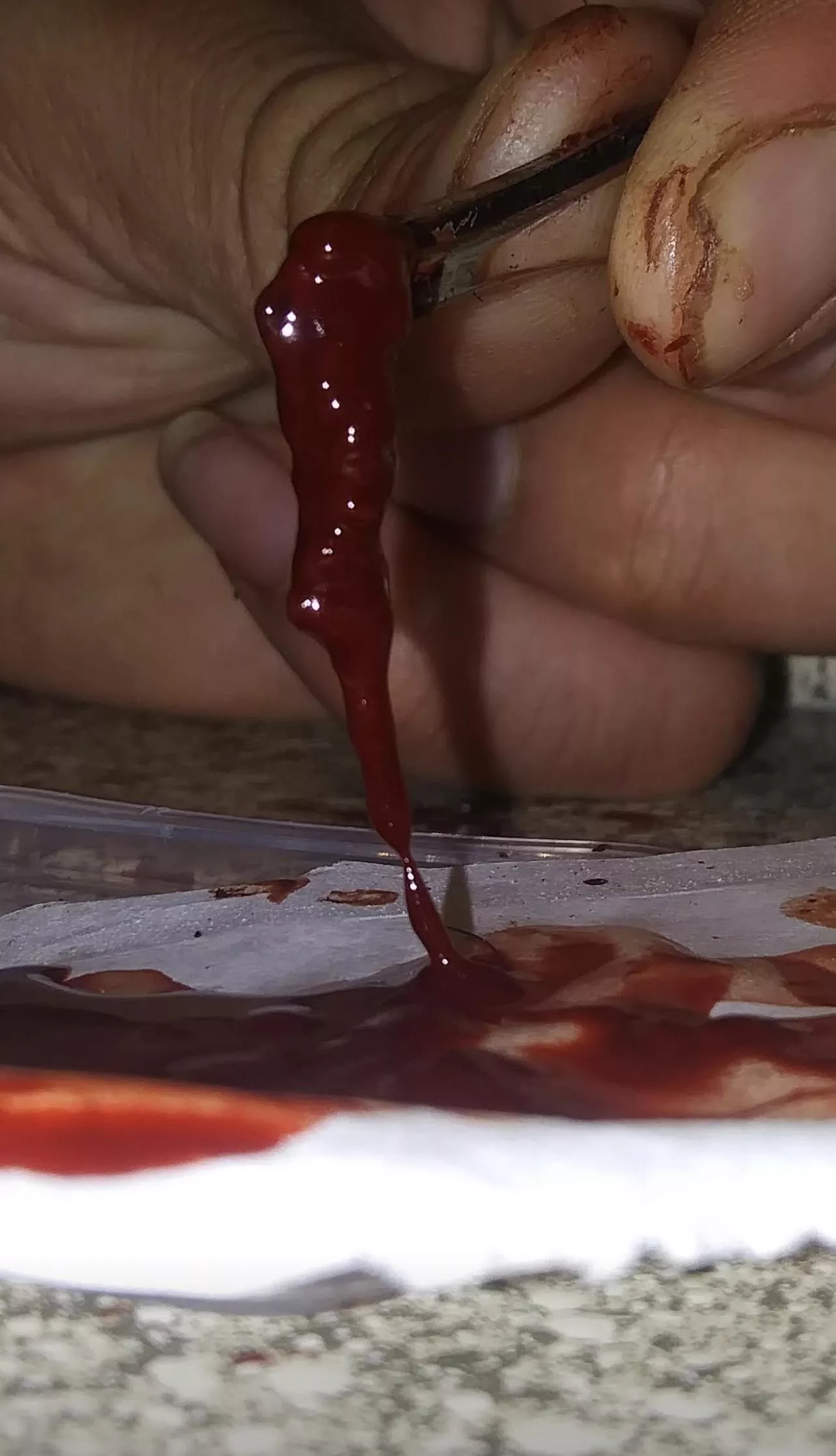 So I pulled this out of my forehead today Not sure what to make of it. At least my headache is gone now