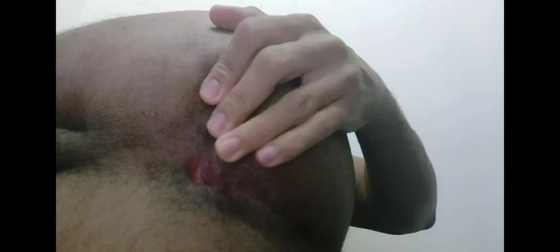 tell me what does this ass need?