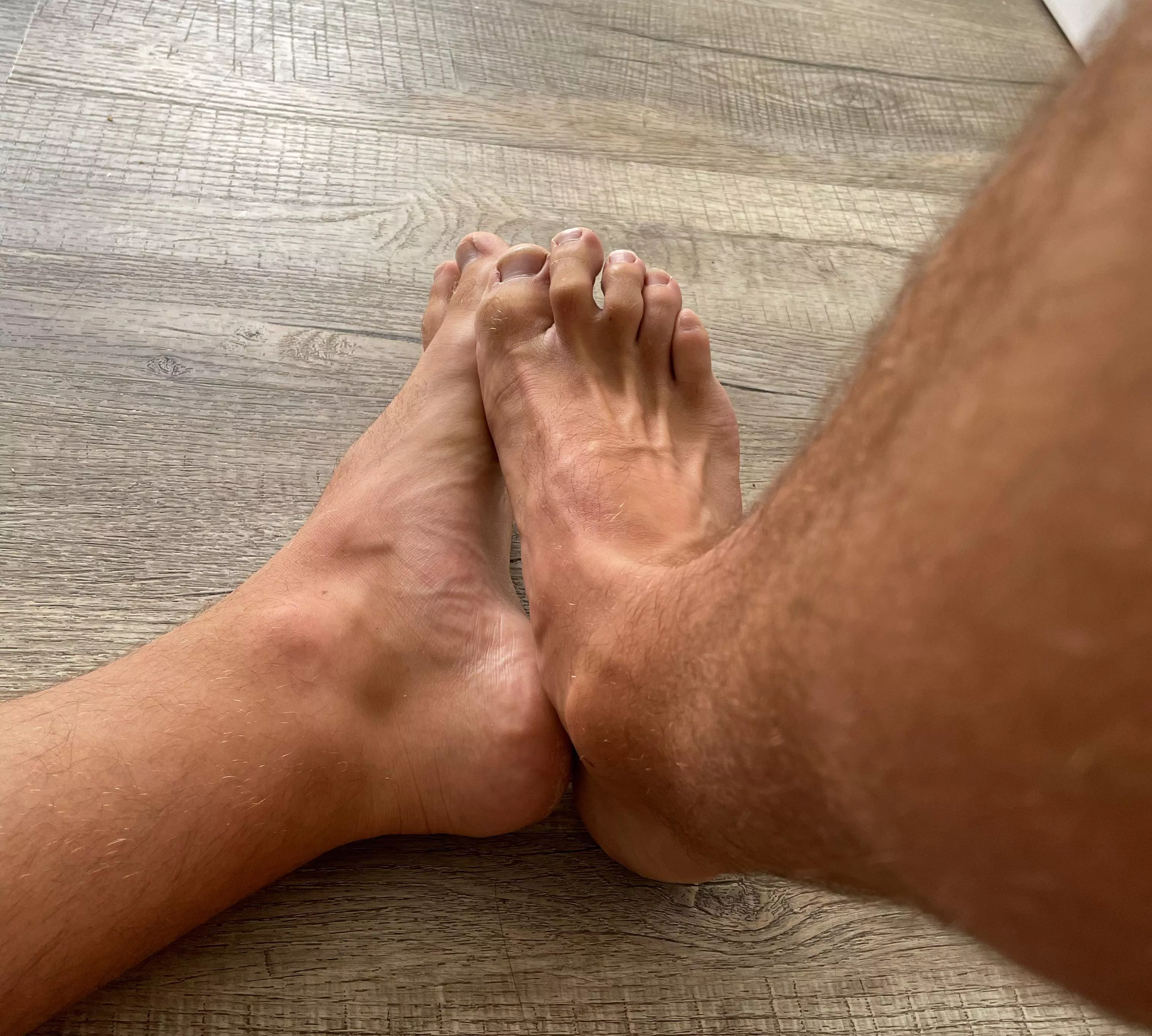 Do you like veins and hair?