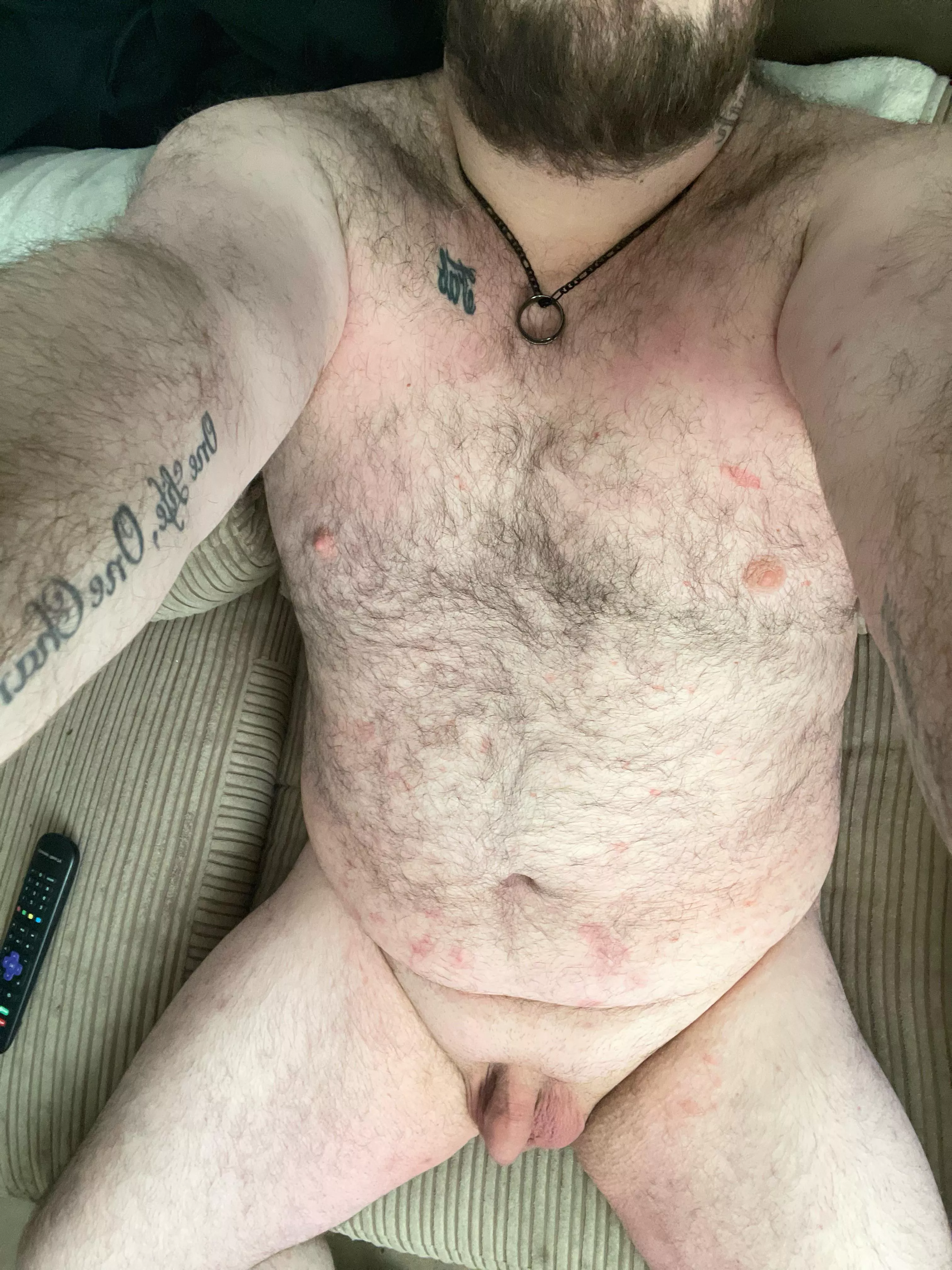 Feel free to say hi. Really horny! Yes I have a skin condition but that doesn’t stop me being me. Say hi. Fully vers here.