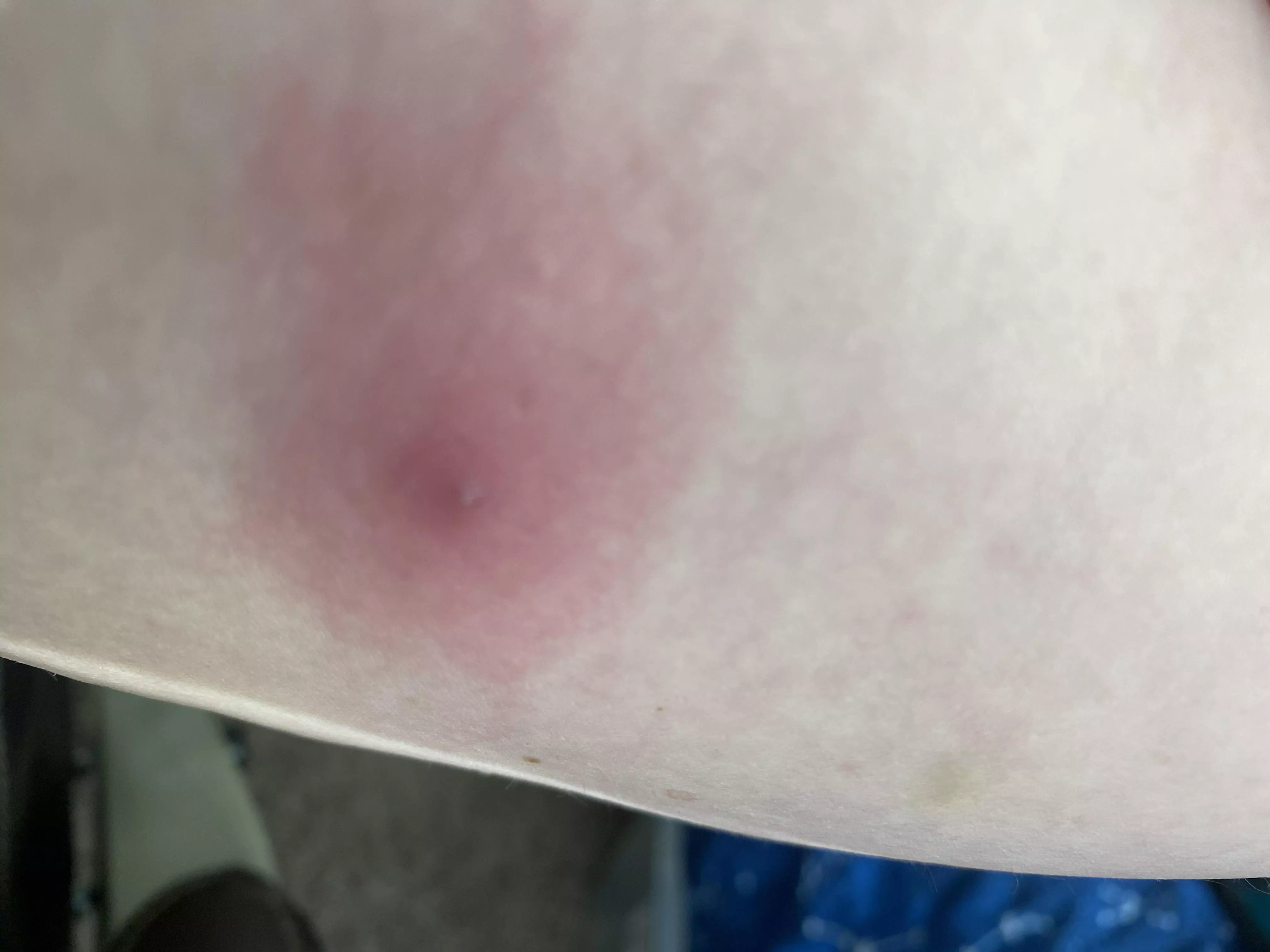 It’s so painful, what do I do?