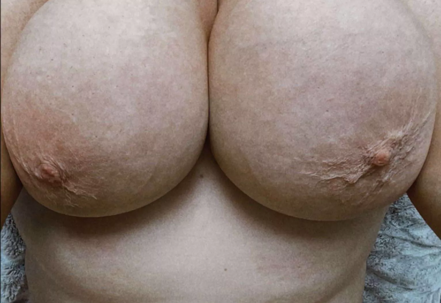 Sunday morning tits 🍉🍉