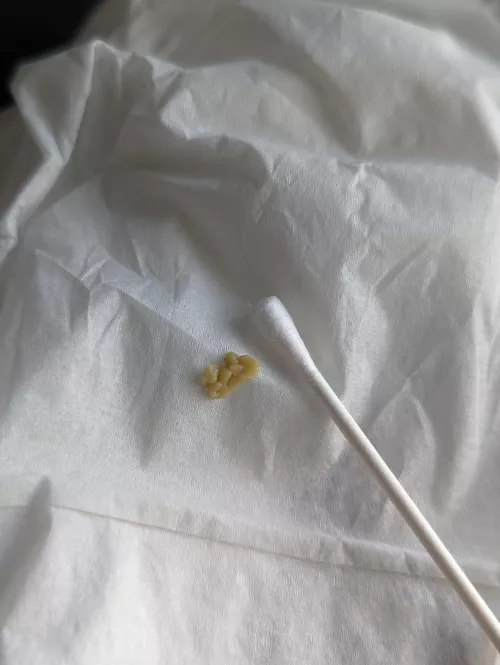 Had a sneezing fit and this nasty mf appeared in my mouth.