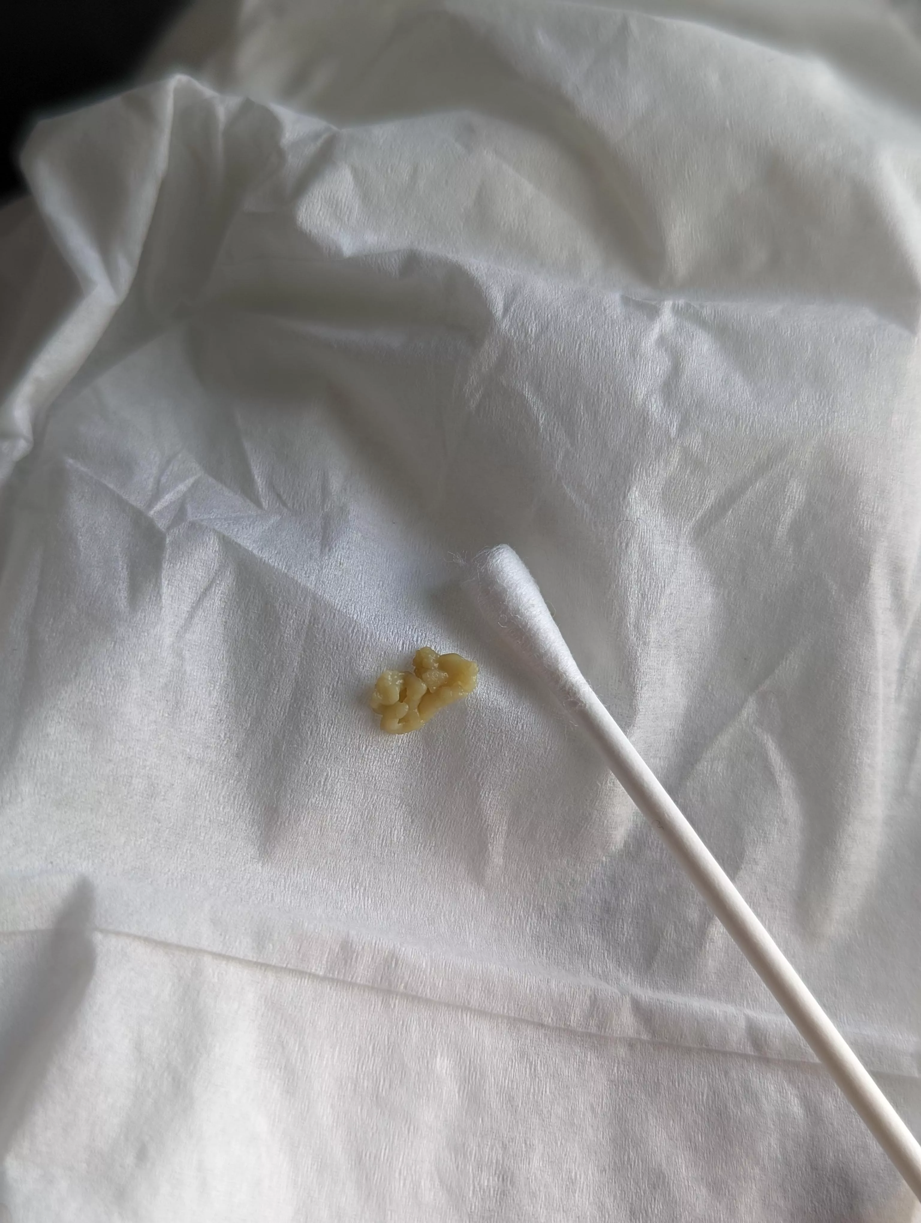 Had a sneezing fit and this nasty mf appeared in my mouth.