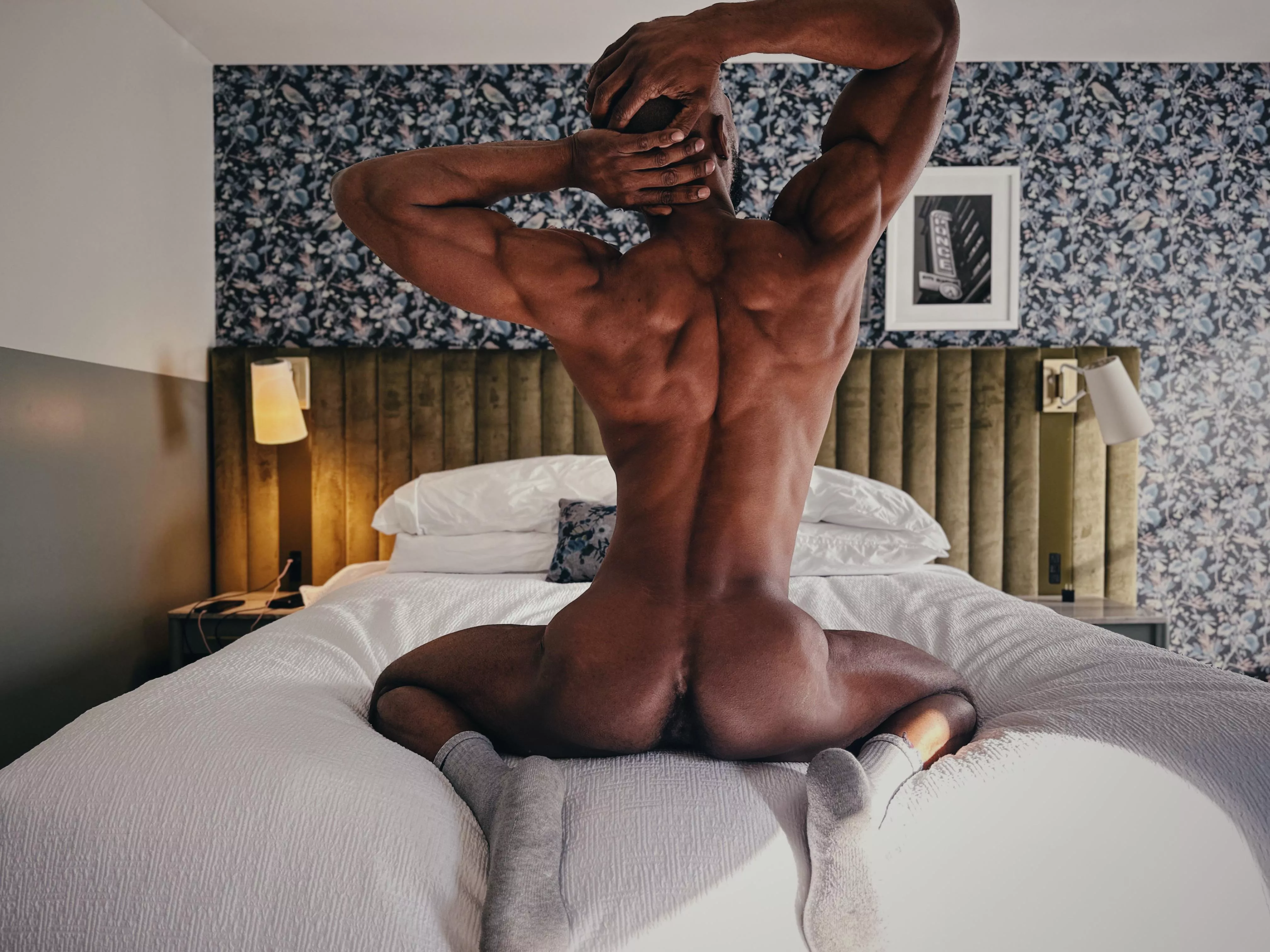 How does my back look?