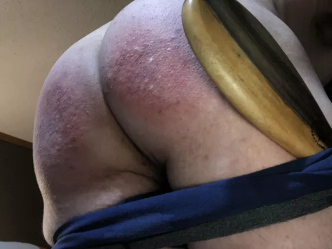 My wife’s handy work. Stings so good