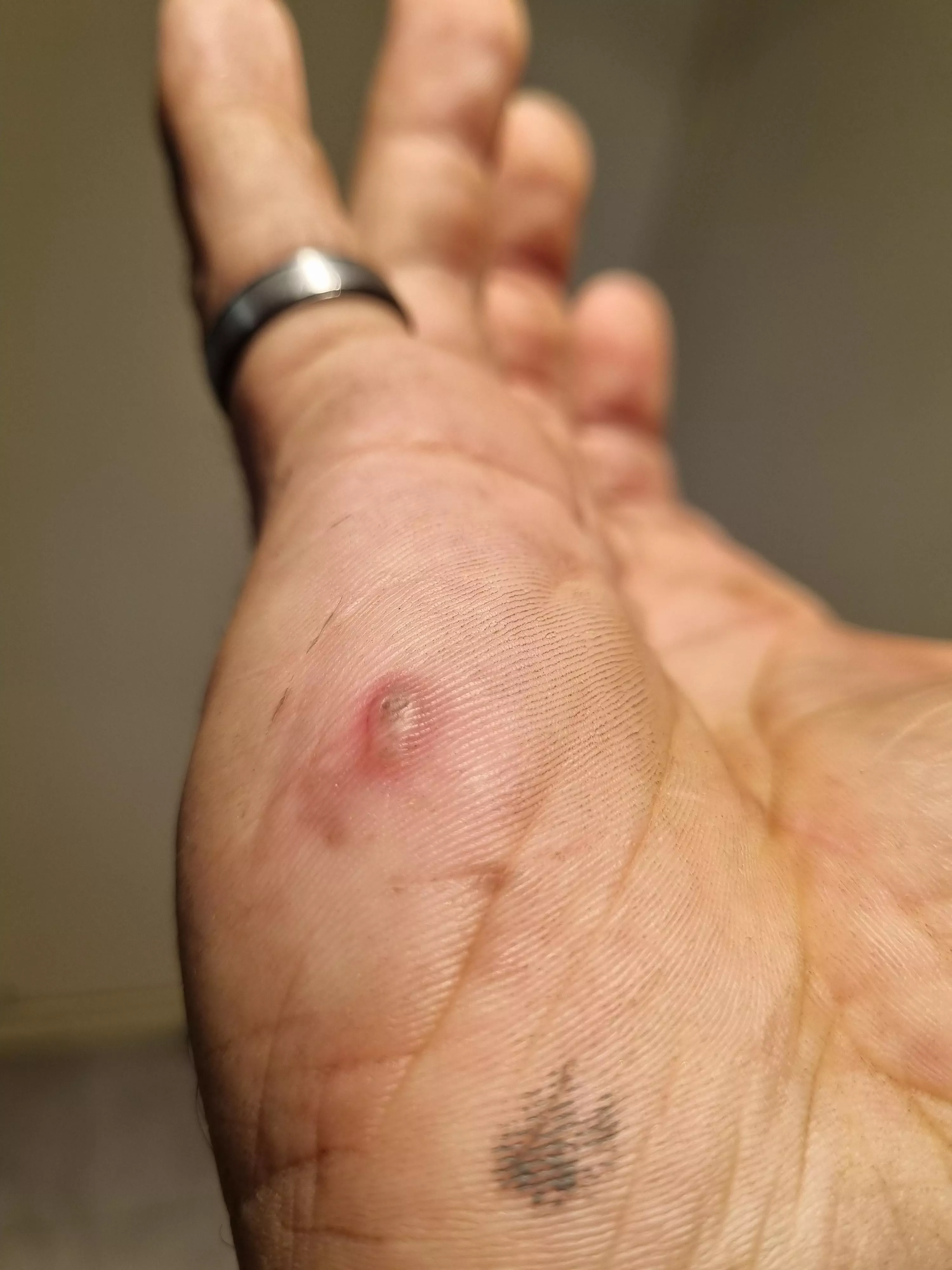 An angry little burn I scored a few days back
