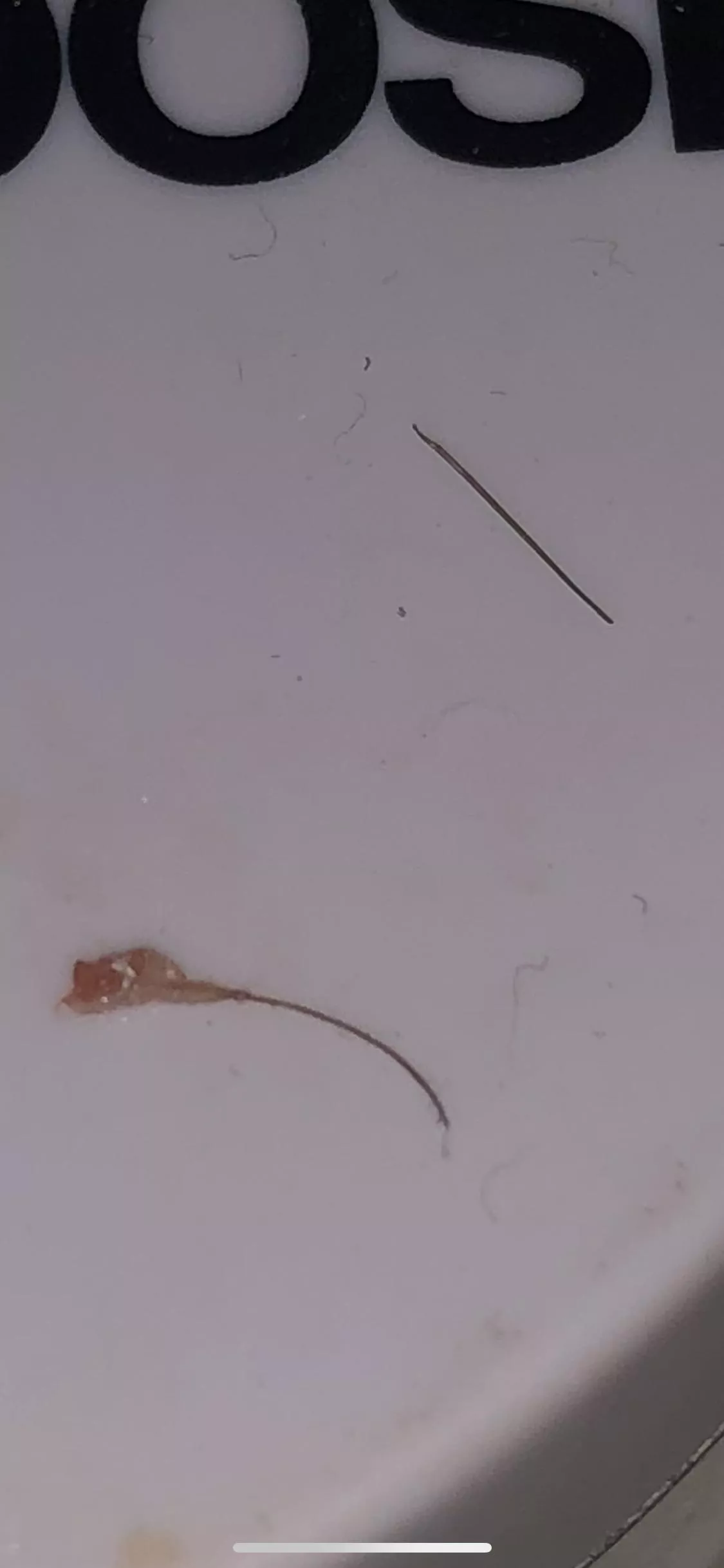 Had ingrown hair bump, I squeezed it and this monster popped out (next to ‘normal’ hair. Why does it look like this?