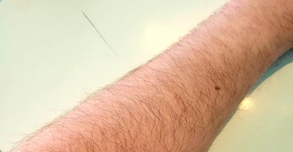 Here's my left. My right is for premium subscribers only.