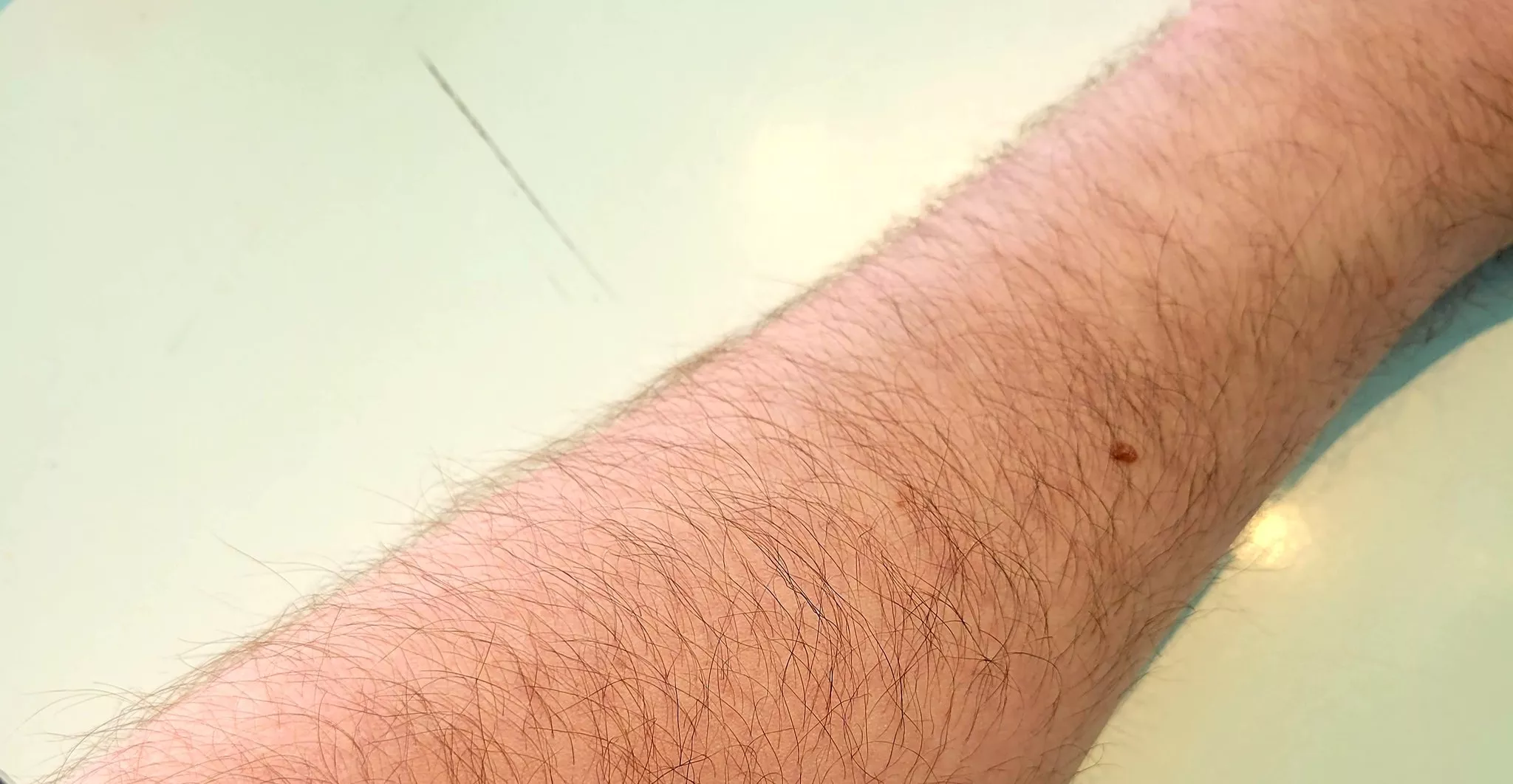 Here's my left. My right is for premium subscribers only.