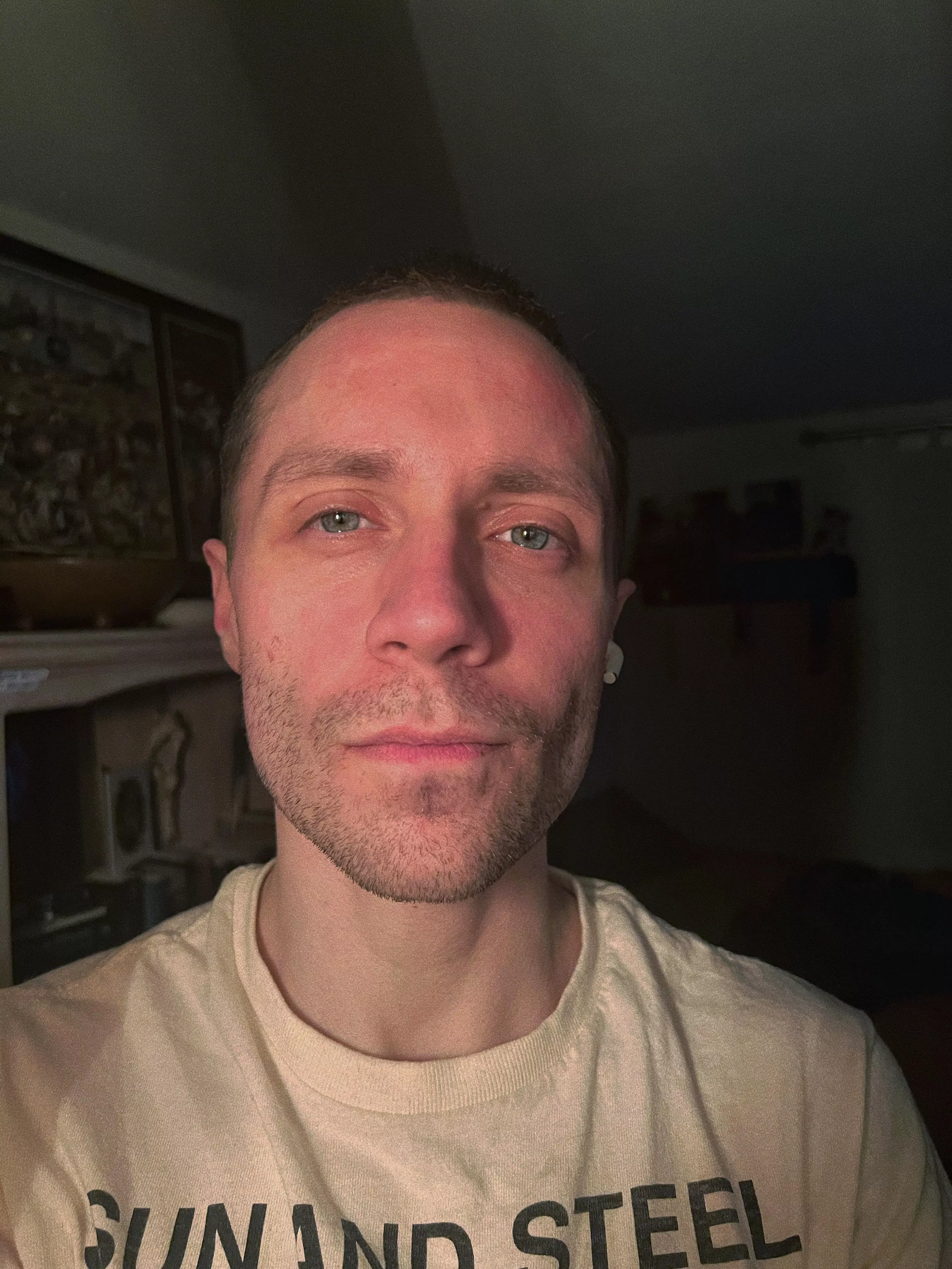 I’ve always been told I have serious RBF