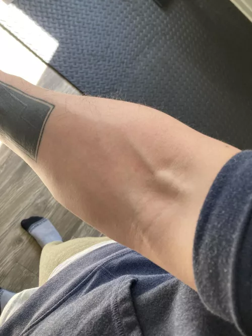 Nurses love my veins 💉🩸