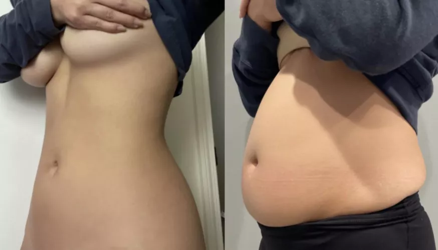 Starting to let myself go...