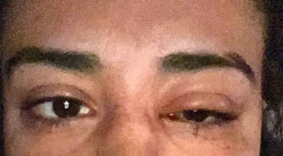 Woke up with green goop and this bad boy. Forbidden pop.