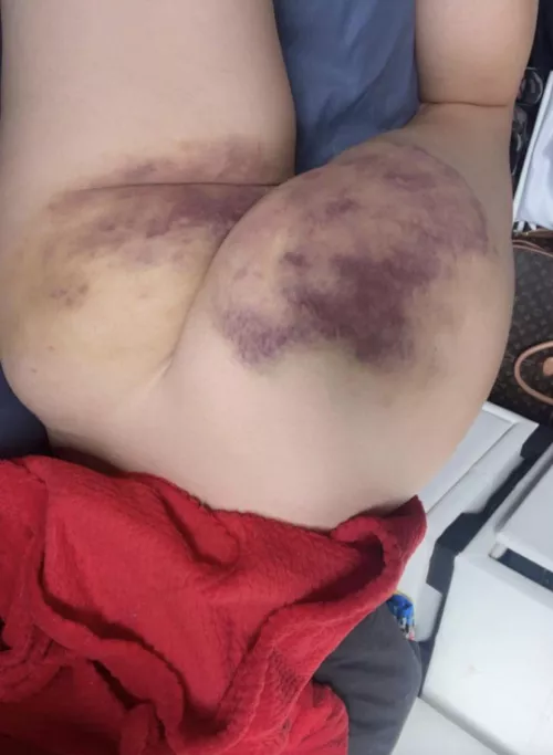 Aftermath of my previous post