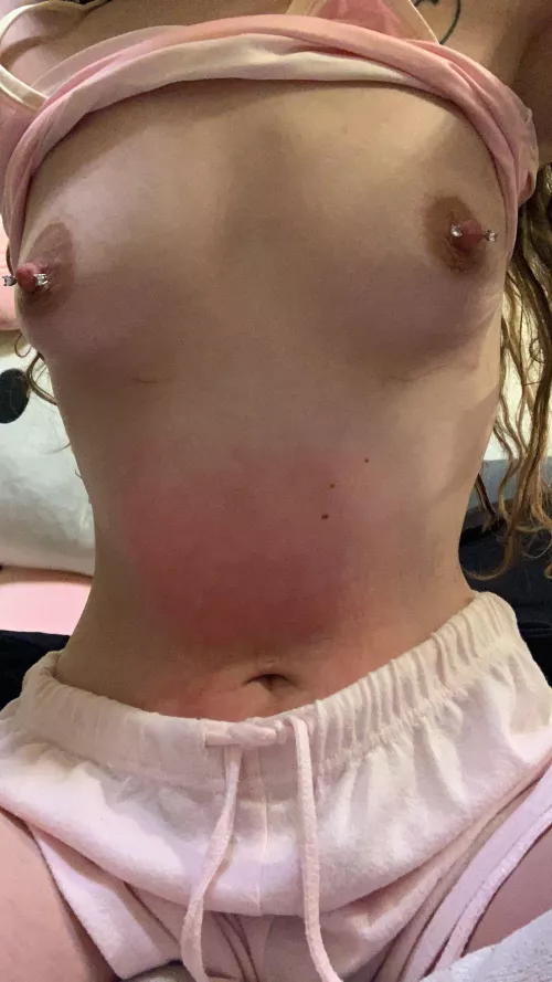 Hot water bottle marks because I’m a cold girl