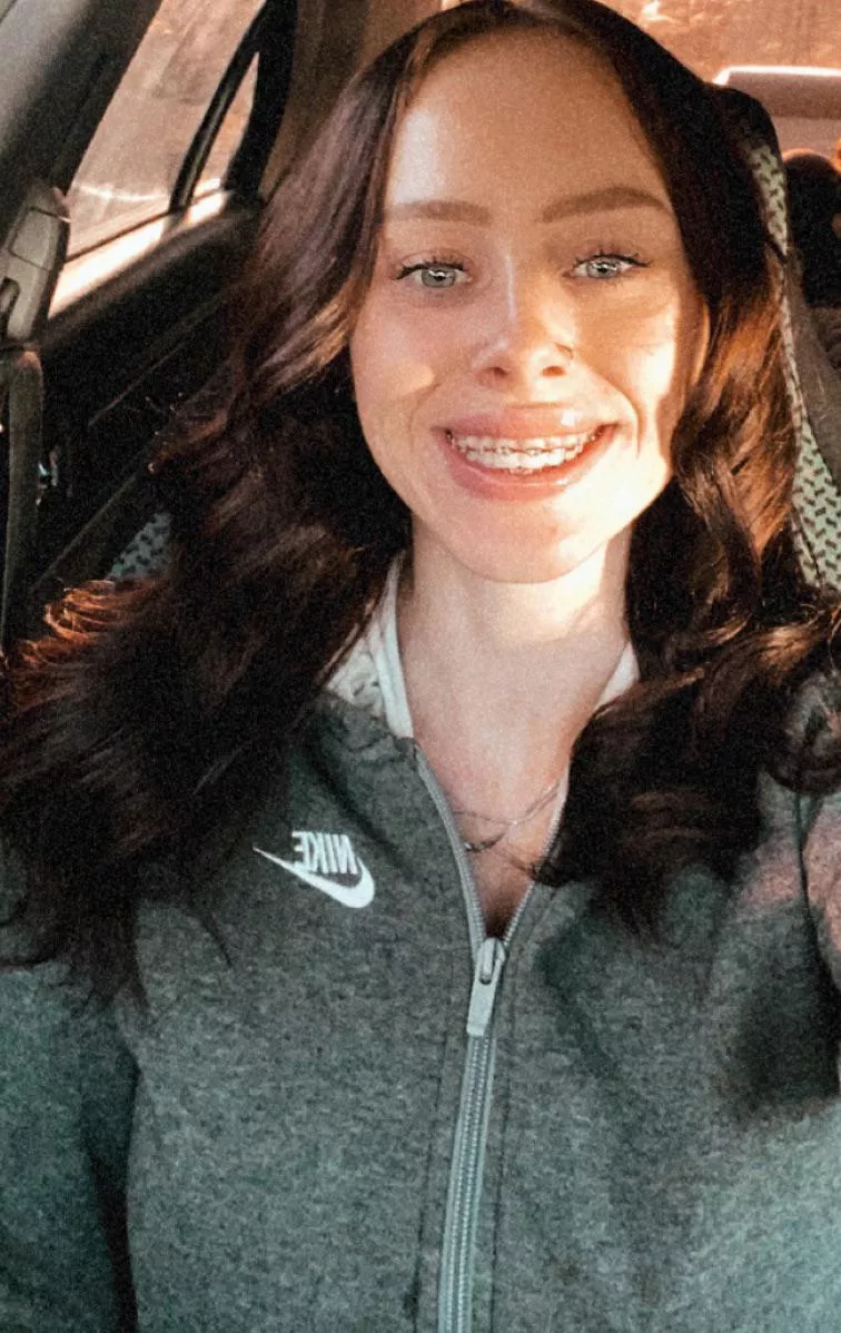 How do my teeth look?