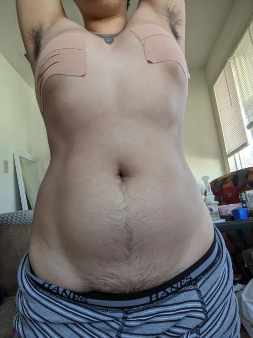 just wanted to show off my body hair, one year on T anniversary