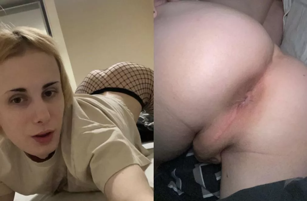 Lips in the front and lips in the back 🤣