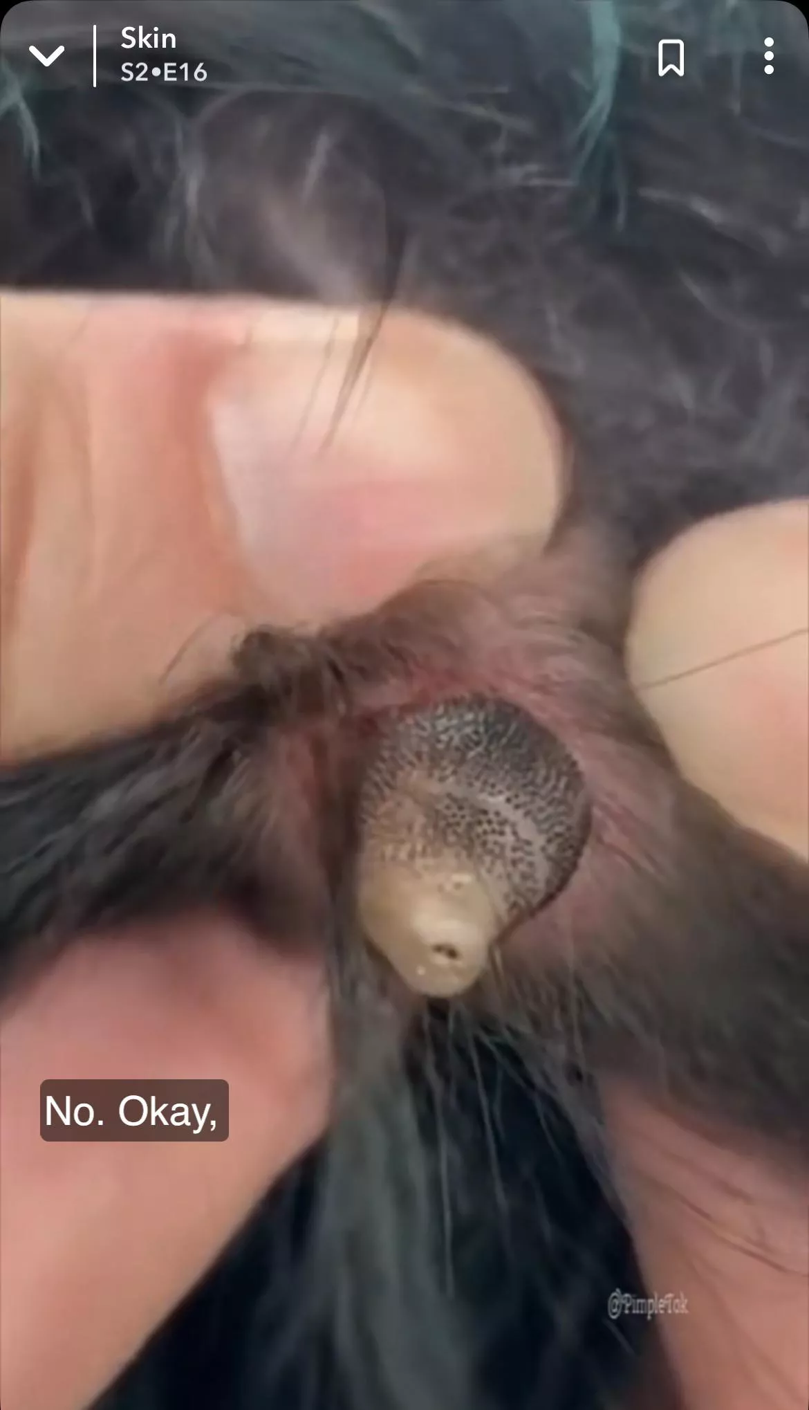 My friend sent me this screenshot from Snapchat. Is this an actual bug??