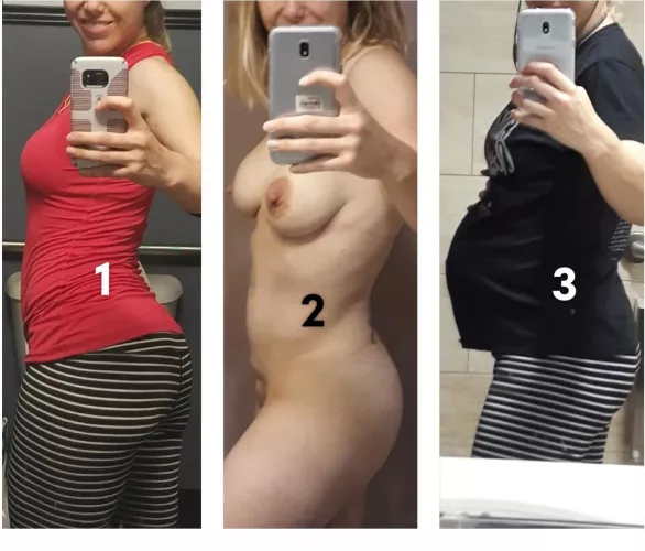 Which stage does she look better in 1 before 2 after or 3 during?