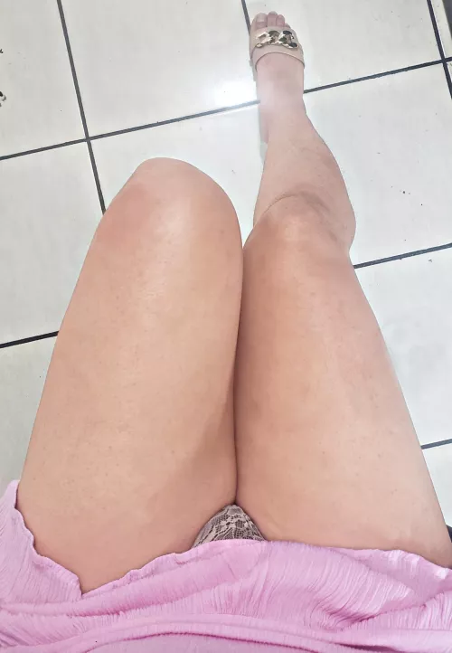 I hate my legs 🥲🥲🥲