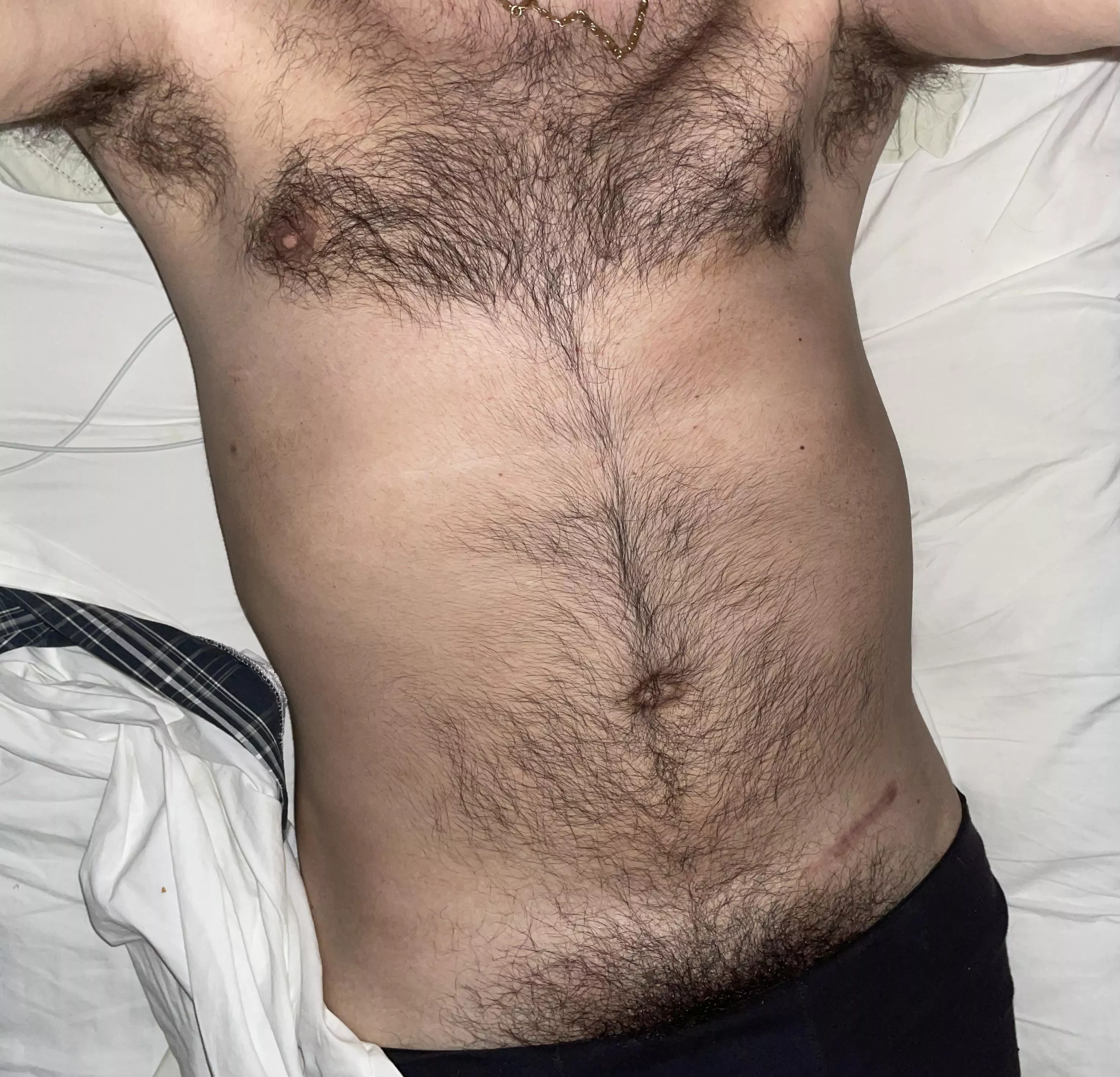 Just a hairy guy…