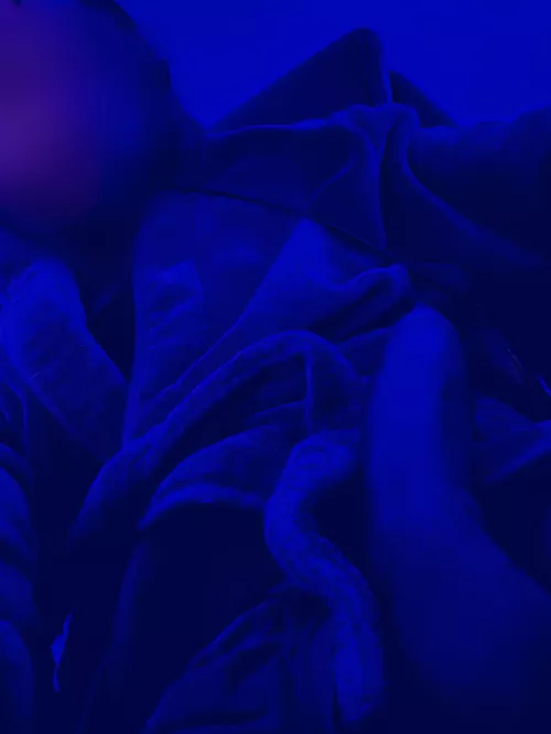 Need me a solid fwb who will help the swelling go down 🌝