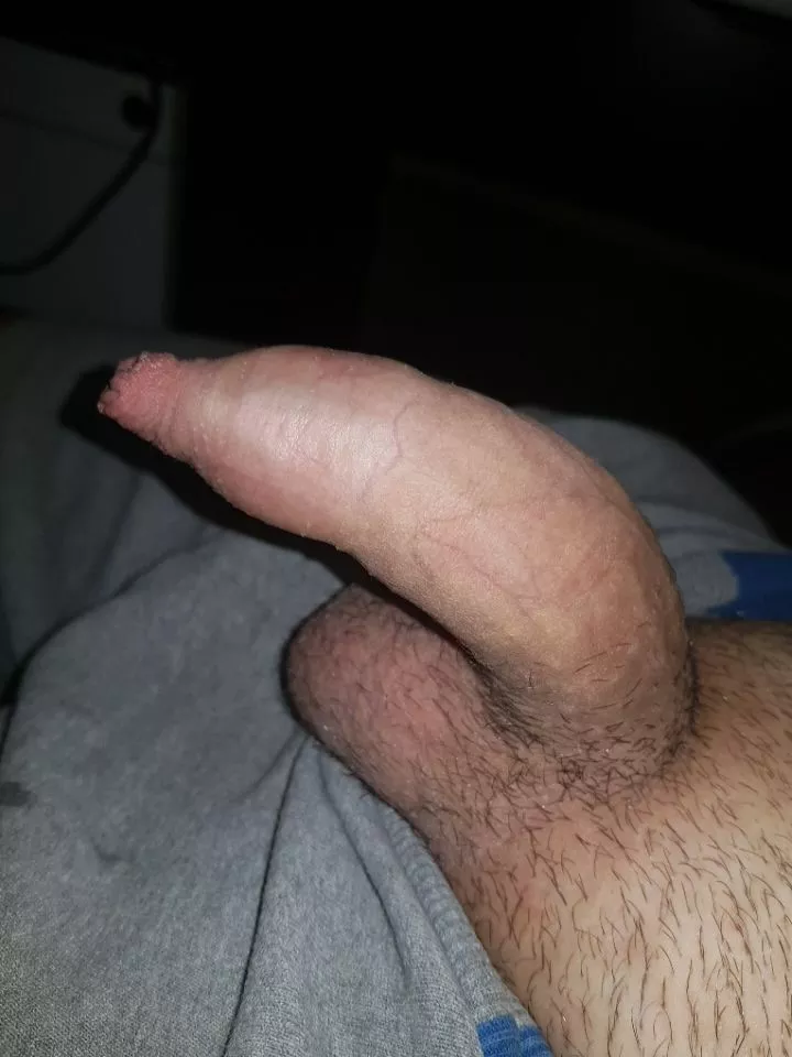 Pms open