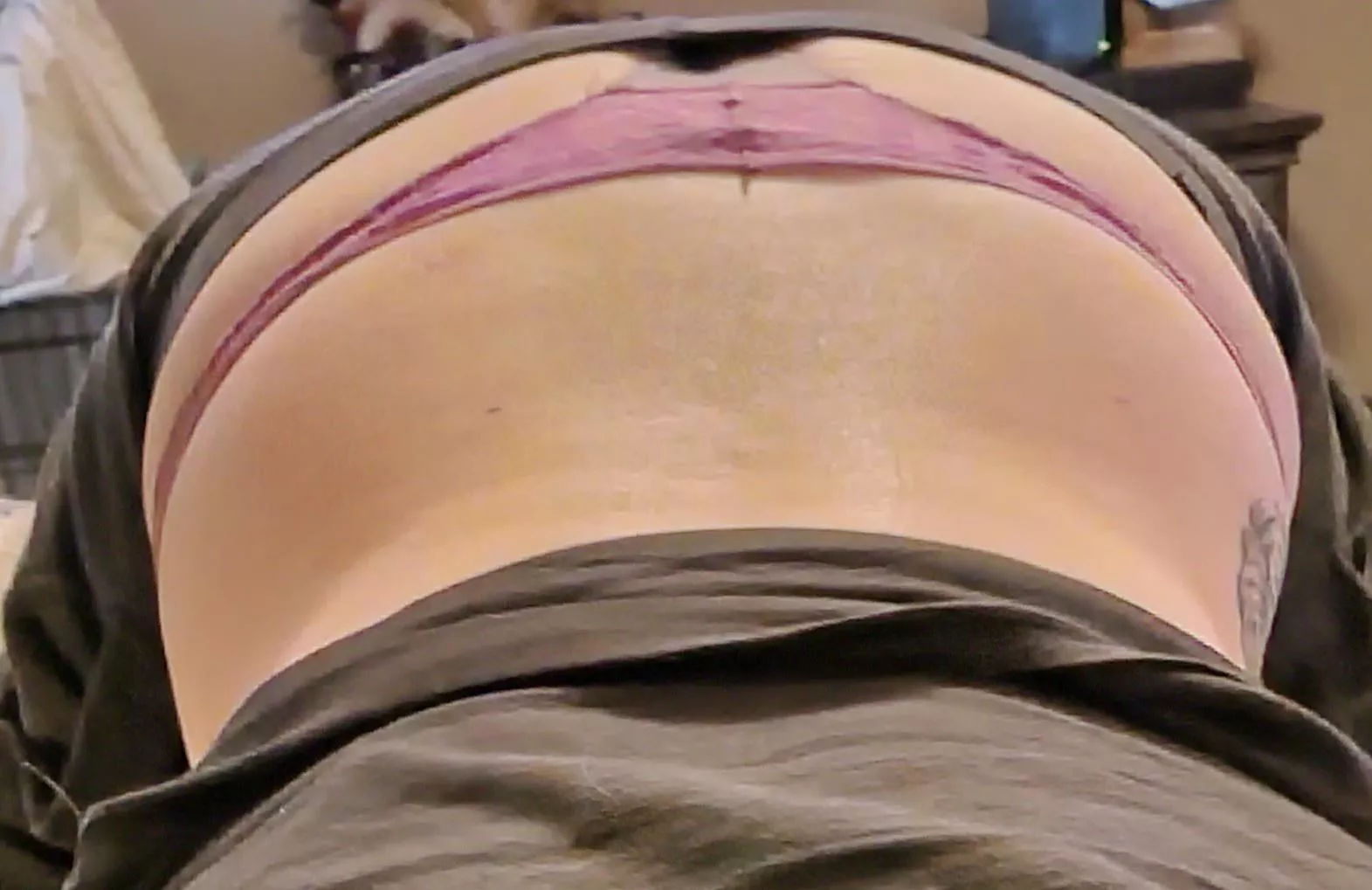 I know my place. On all 4's. Holes plugged.