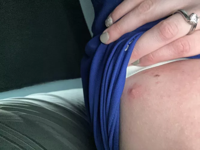 I popped some out this morning only for it to be filled back up.. it’s angry and ready 😍 video anyone?