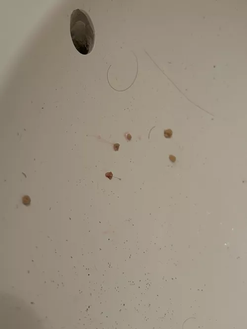 I think i cured my bad breath issue