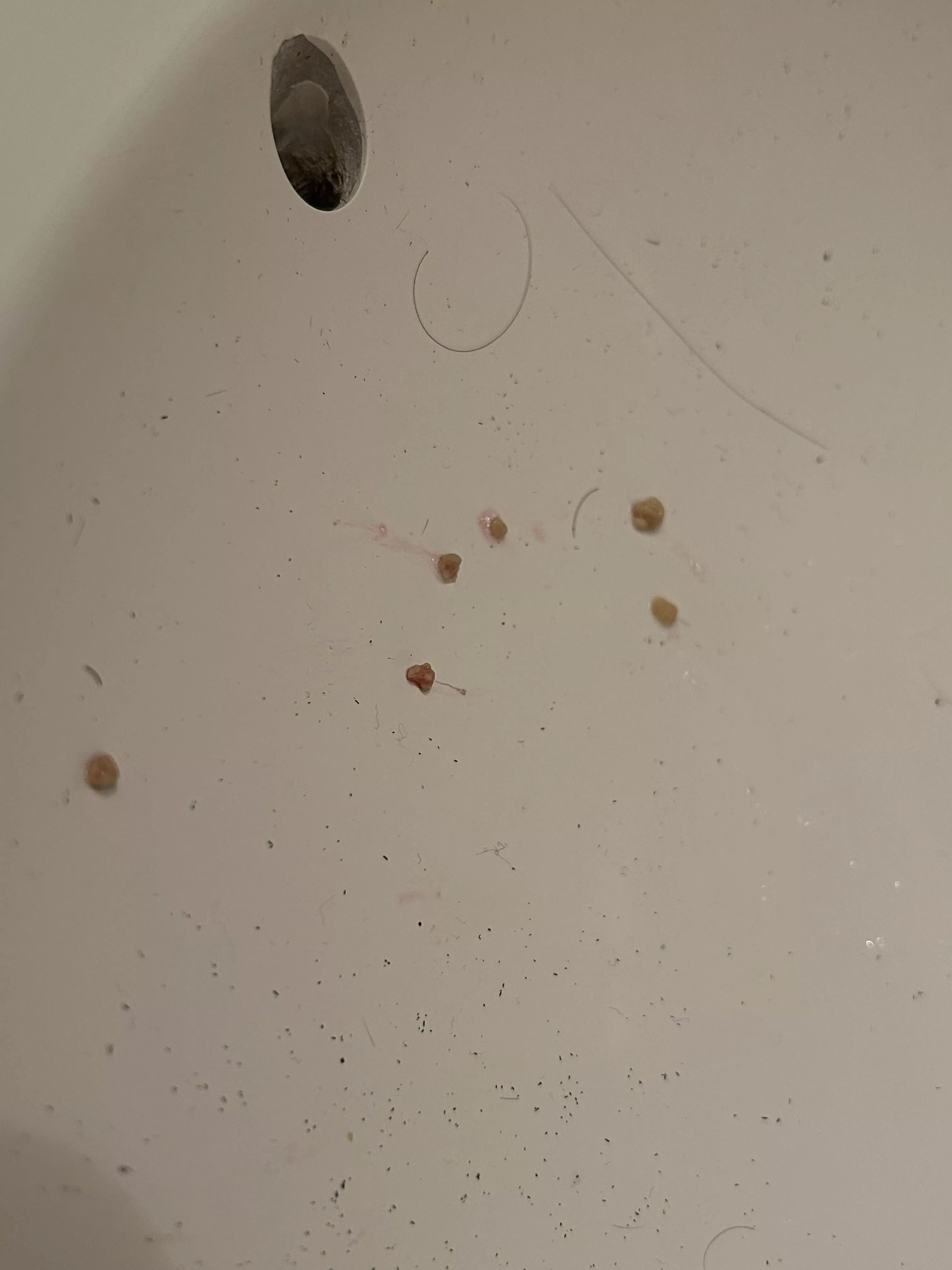 I think i cured my bad breath issue