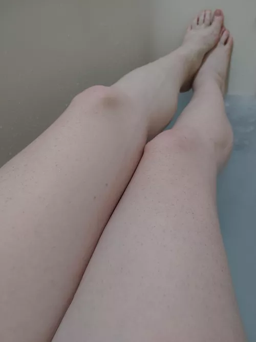 So many freckles on these legs.