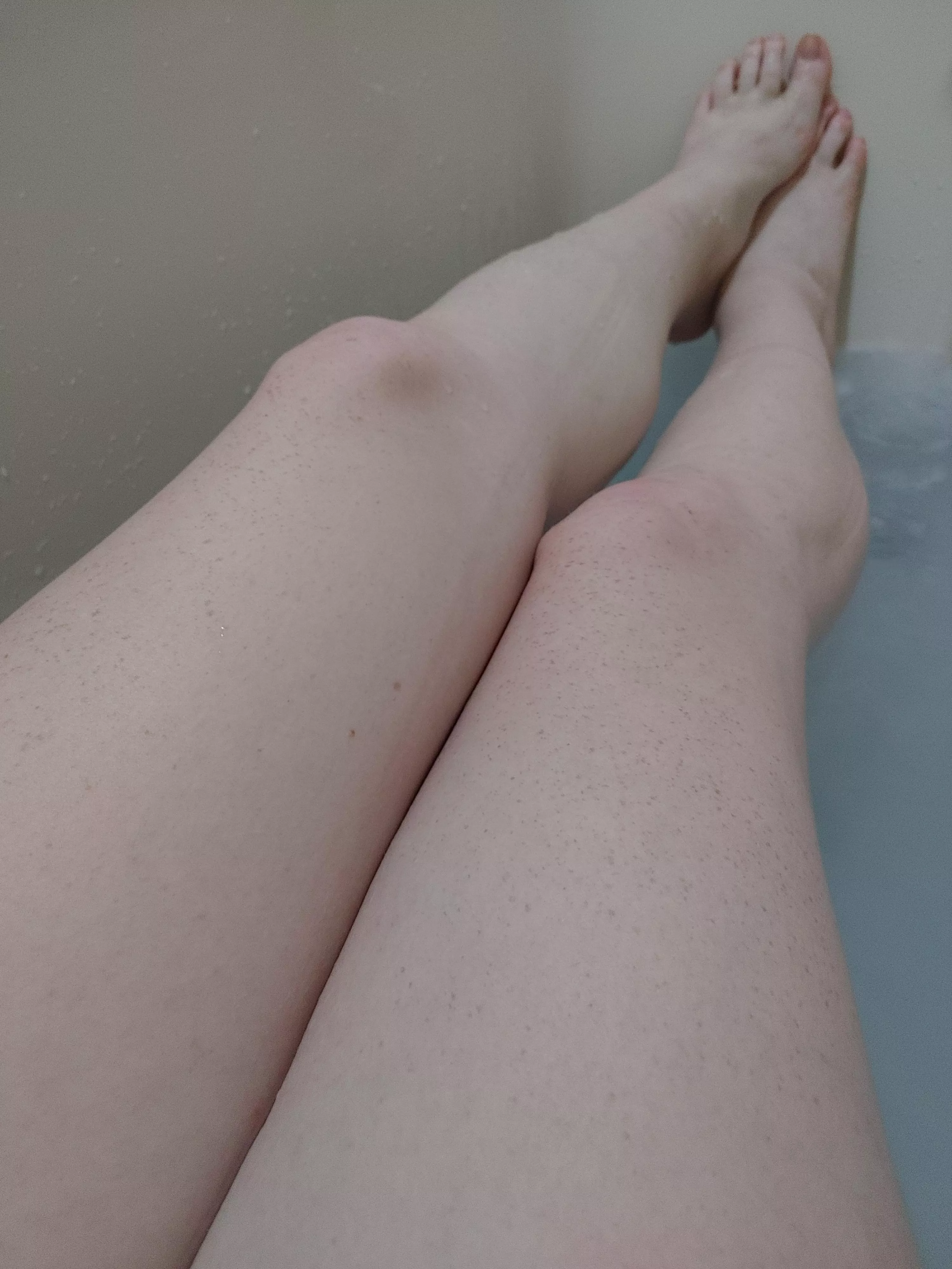 So many freckles on these legs.