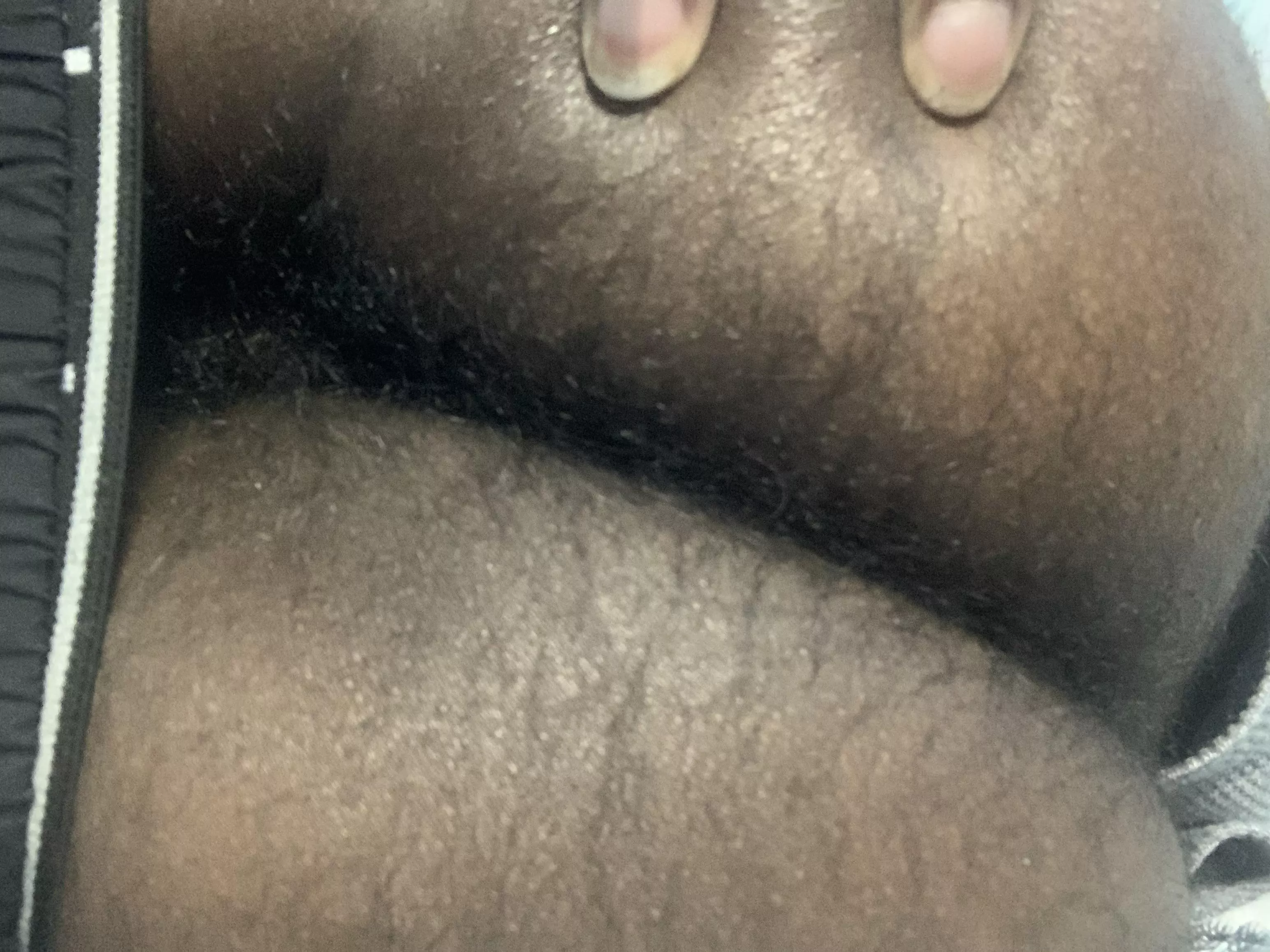 18yo with very hairy ass