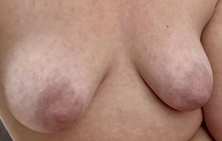 [F34] 1-10 Hope you like my big nips! Rate my juicy naturals in the comments?