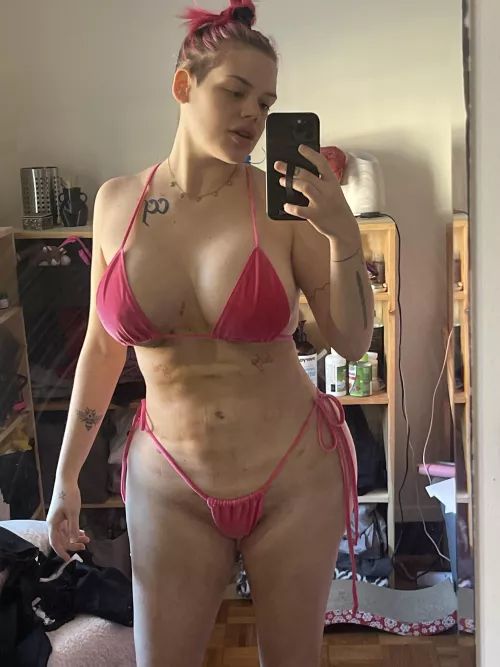 Just 10 days after a 600cc to 1000cc implant upgrade, full BBL lipo transfer and lips…no makeup and still healing so be kind