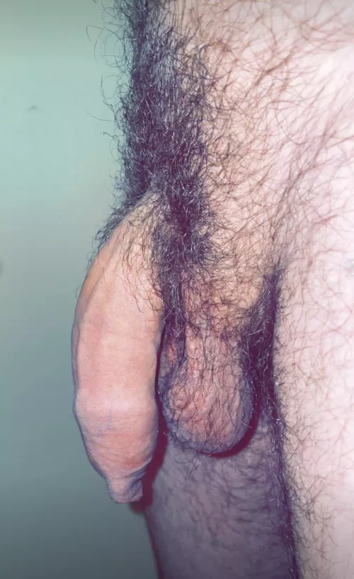 Soft and hairy