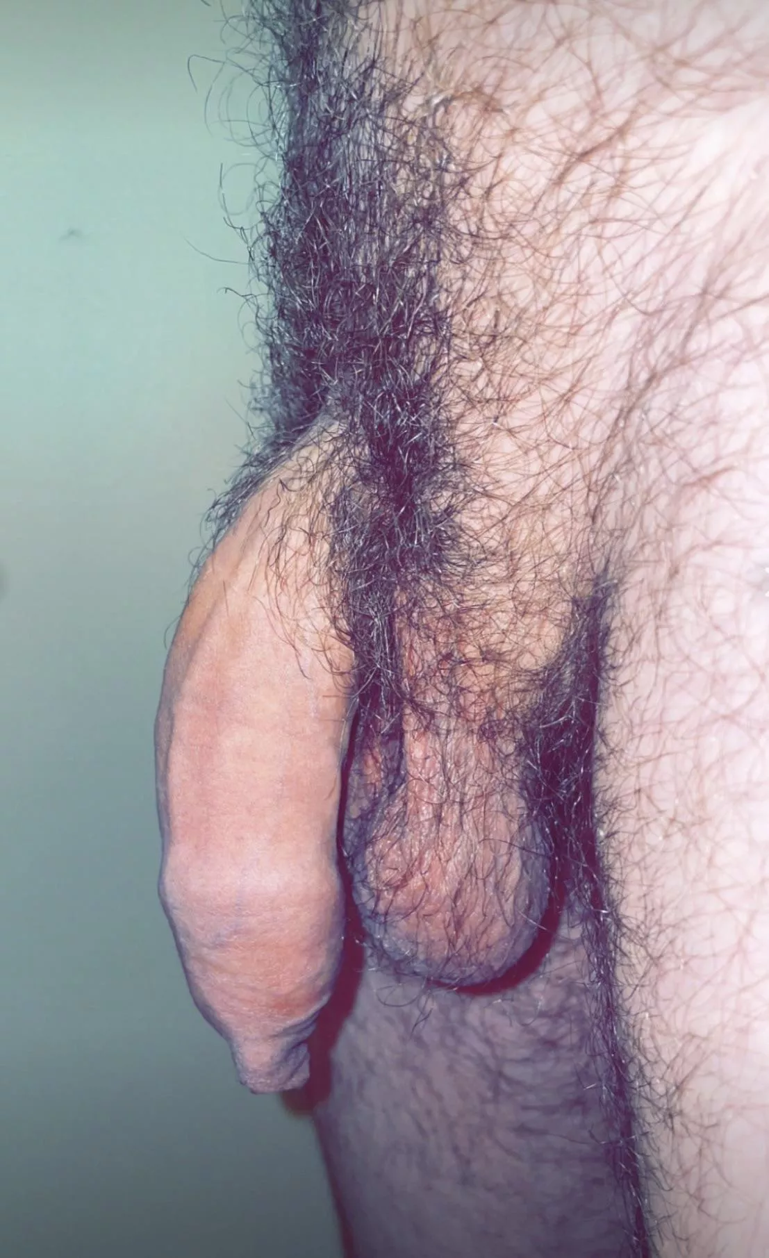 Soft and hairy