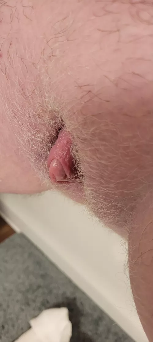 [T4M] FtM trans guy, not sure if this counts/is allowed, but I love that I actually kind of have foreskin now