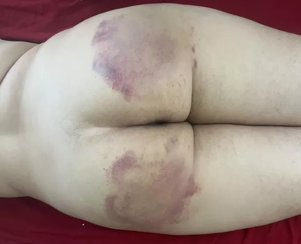A severe spanking is the best punishment for a bratty girl like myself
