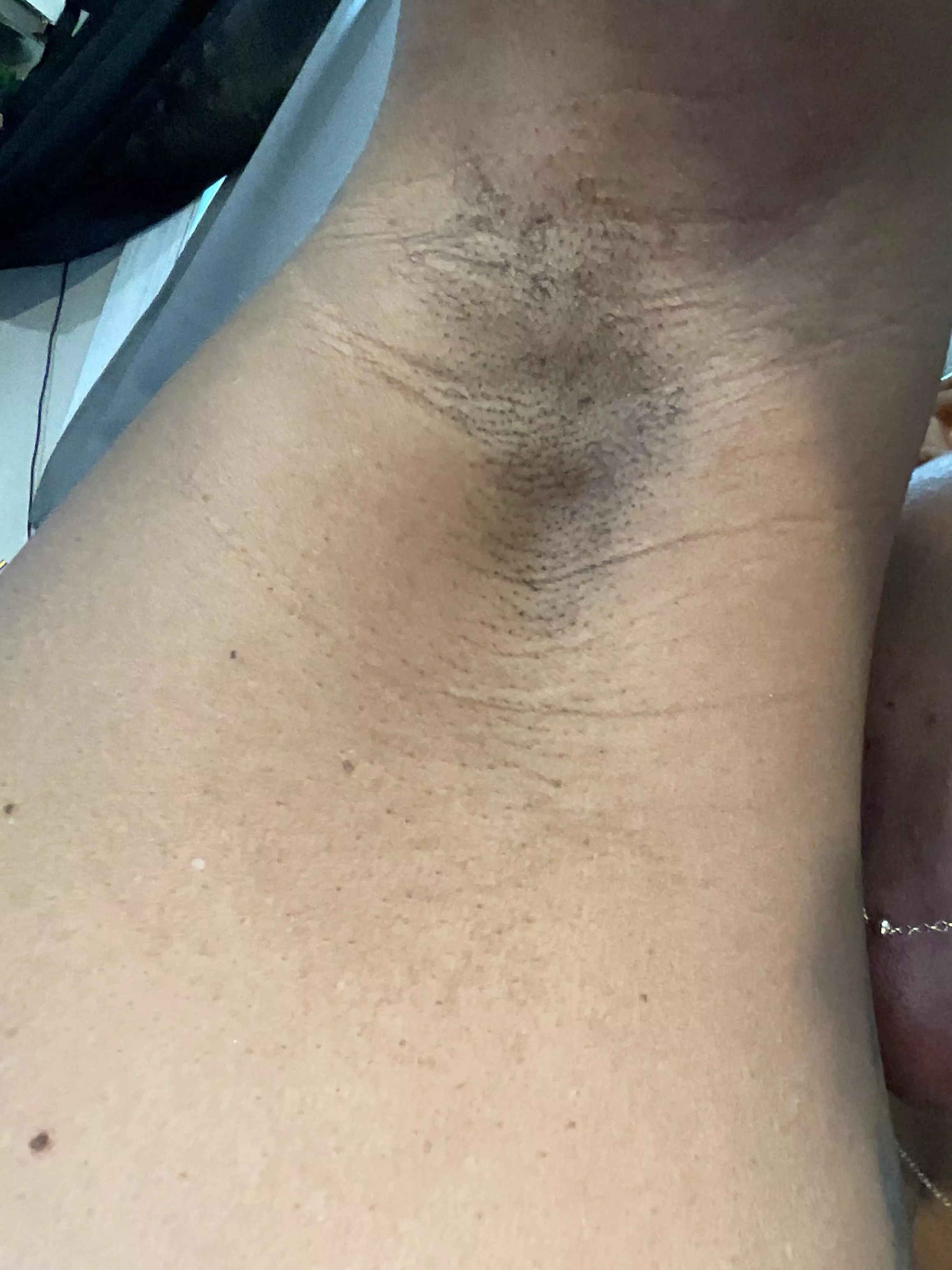 Do I need to shave or am I seeing things?
